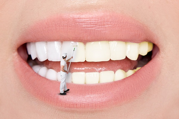 Dental Cleaning Middlesex, NJ