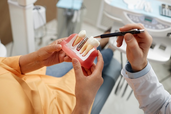 How An Experienced Implant Dentist Can Improve Your Smile