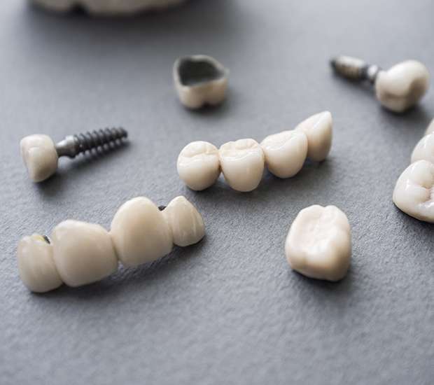 Middlesex The Difference Between Dental Implants and Mini Dental Implants